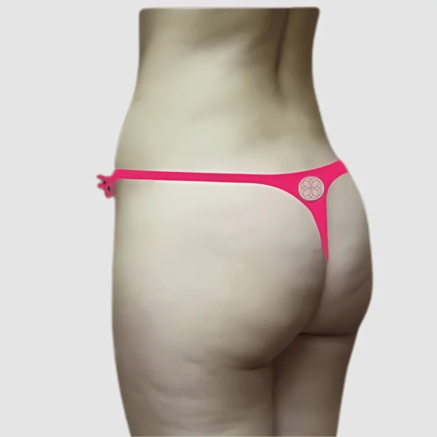 Skinny BBL Surgery before